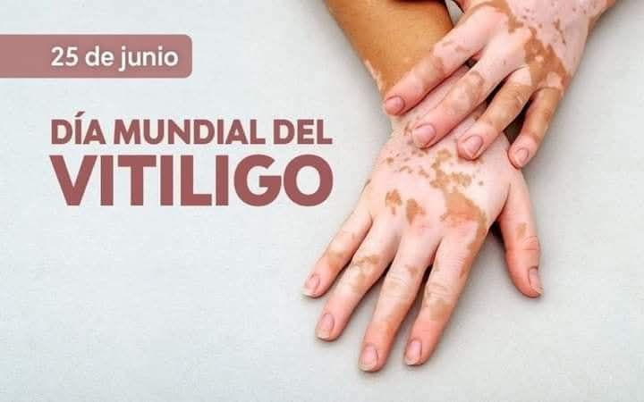 ¿Cómo surgió el Día Mundial del Vitiligo?