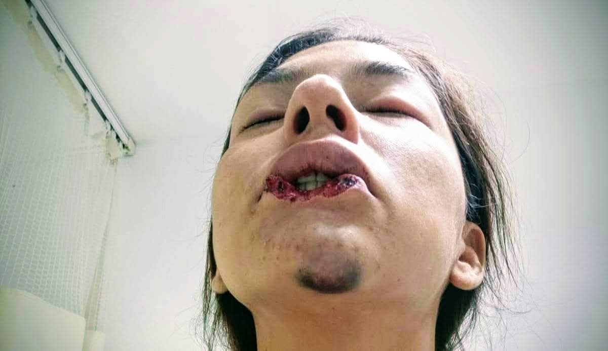 Víctima de intento de feminicidio el 11 de octubre de 2023 denuncia que hasta hoy la Fiscalía General del Estado no ha realizado una sola audiencia